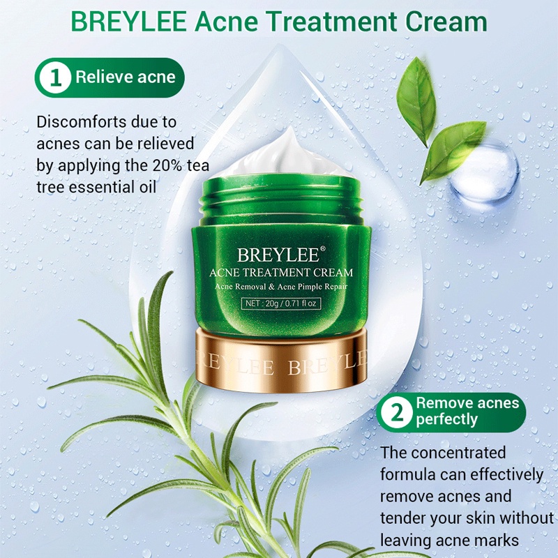 [Ori100%] Allphv Acne Treatment Cream Penghilang Jerawat Anti Acne Pimple Removal Spots Oil Control Shrink Pores Moisturizing Face Krim 20g Perawatan &amp; Kecantikan