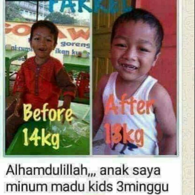 SUPLEMEN PENAMBAH BERAT BADAN ANAK