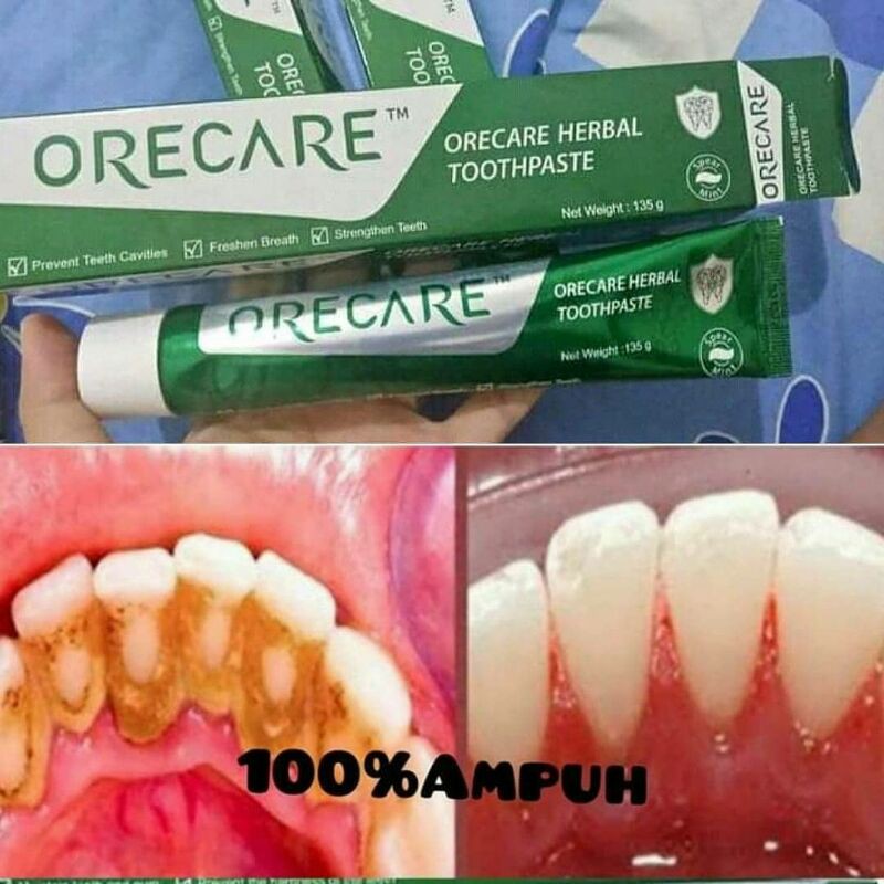 PASTA GIGI (orecare)