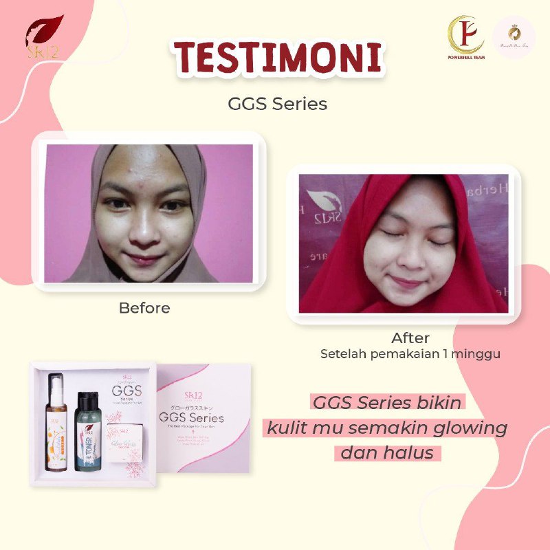 GLOW GLASS SKIN GEL | GGS SR12 | MENCERAHKAN KULIT WAJAH | MEMUDARKAN FLEK | KRIM GLOWING BPOM