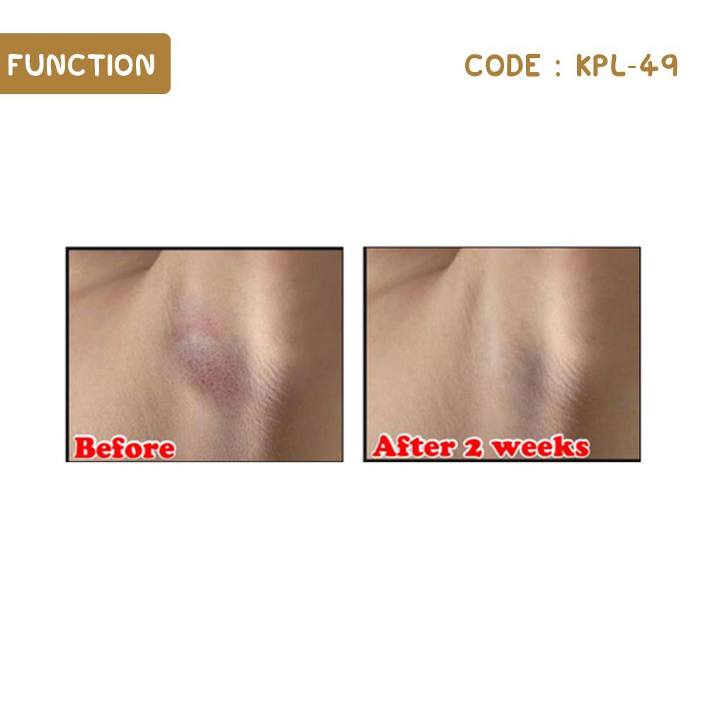 [ORI] Shin Kurim Pemutih Krim Pencerah Ketiak Selangkangan Halus Tanpa Bau dan Iritasi dalam 3 Minggu