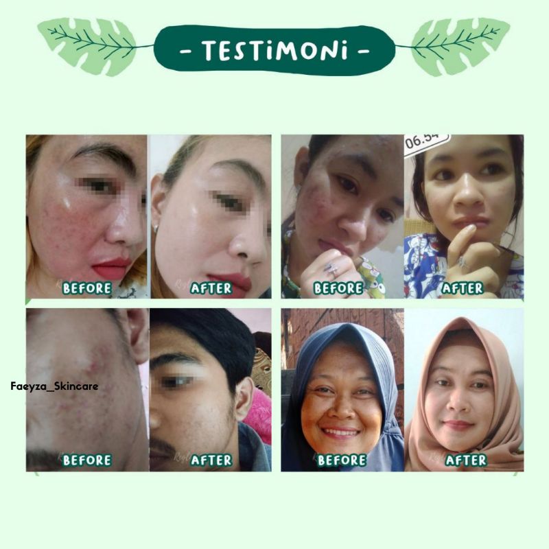 Paket Cream Skincare Kit Acne Pemutih Pria Wanita BPOM Reglow Glowing Skincare Routine | Tas nindhy Moonzaya