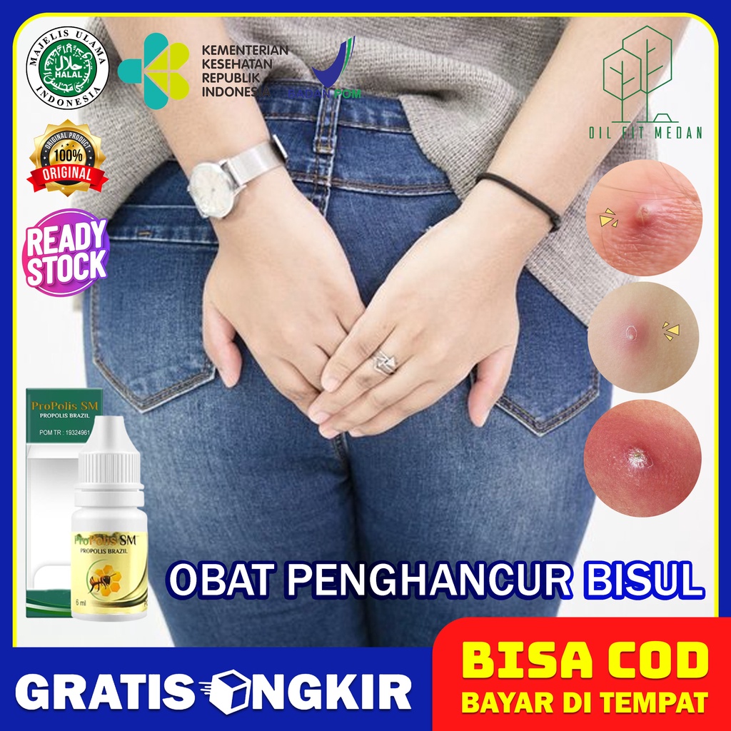 Obat Bisul Pantat Alami Agar Cepat Pecah - Bisul Pantat Biar Gak Tumbuh Lagi - Bisul Pantat Cepat Pe
