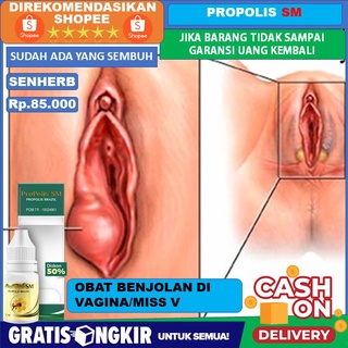 Obat Benjolan Di Vagina 100 Herbal Benjolan Di Atas Kemaluan Benjolan Di Bibir Kemaluan Dll Shopee Indonesia