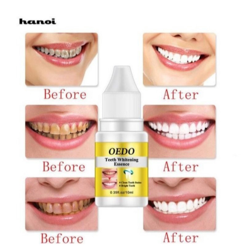 OEDO TEETH WHITENING ESSENCE | PEMUTIH GIGI PERMANEN