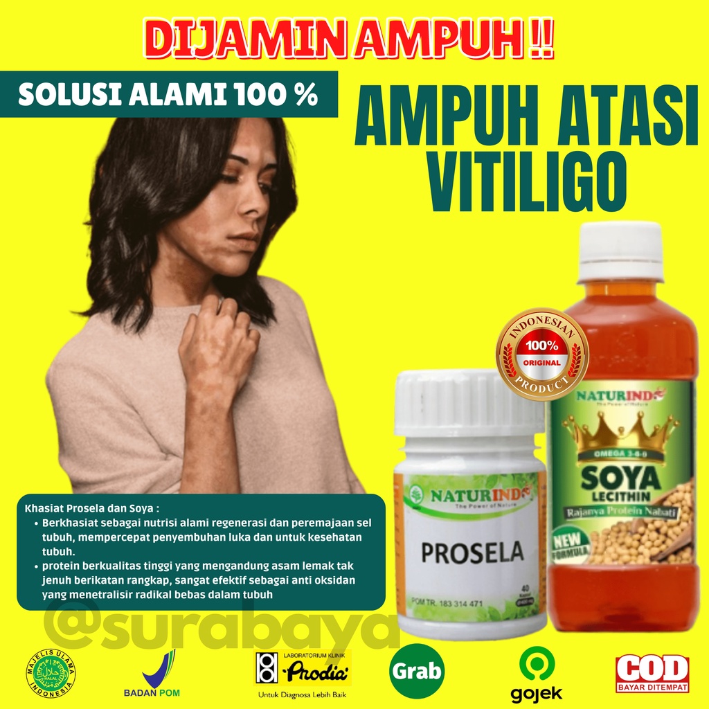 Obat Herbal  Vitiligo Kulit Kasar Ampuh Strechmark Kulit Bergaris Herbal Ampuh Prosela Soya Lecithin