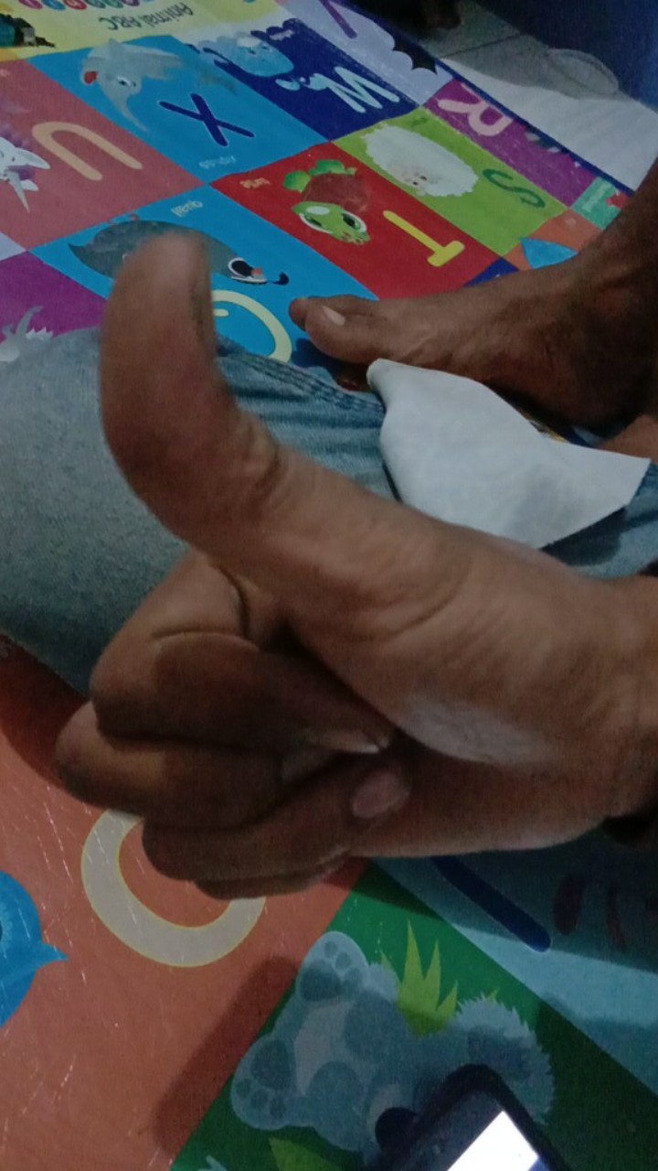 Lem Epoxy Besi Araldite Rapid 5 Menit Merah