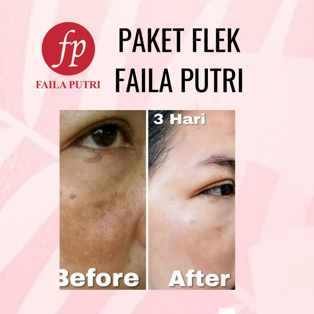 PAKET FLEK FAILA PUTRI/ ATASI FLEK DAN KUSAM