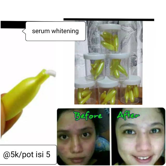 Serum wajah, serum whitening