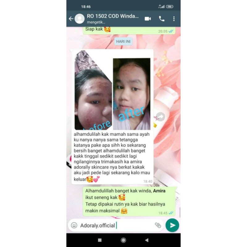 ADORALY SKINCARE ORIGINAL - SKINCARE GLOWING JAKARTA FREE HADIAH-7