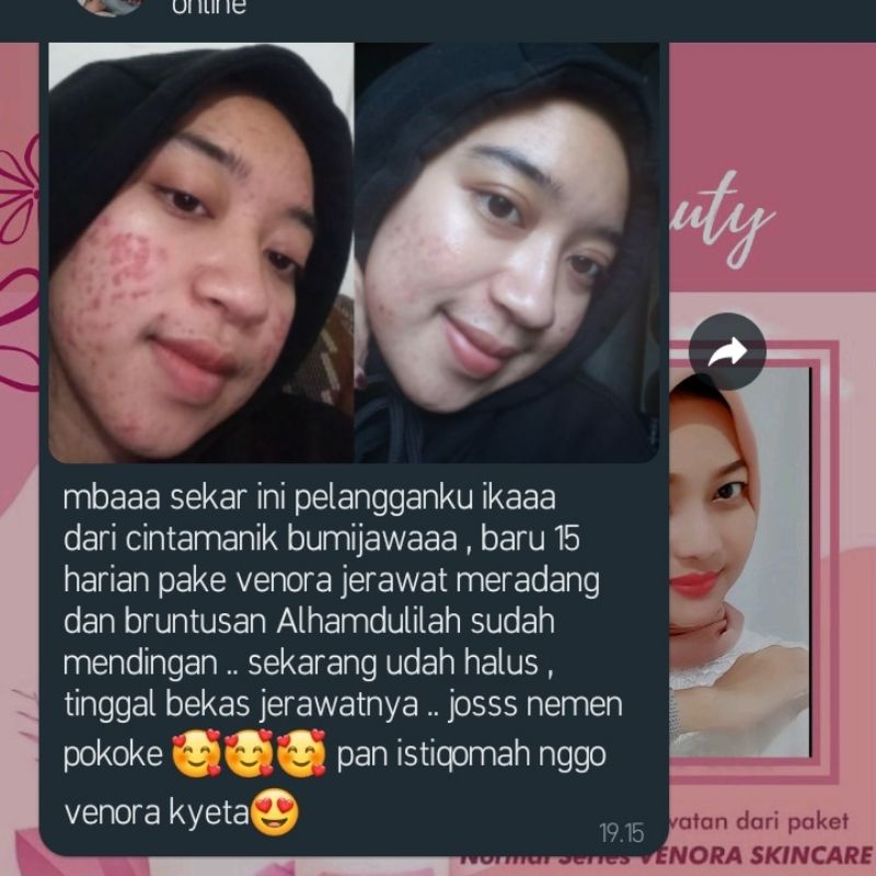 VENORA SKINCARE TERLARIS READY STOCK ! PENGHILANG JERAWAT . PEMBERSIH PENGHILANG JERAWAT .BIKIN GLOWING , BEBAS FLEK HITAM