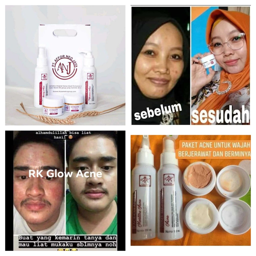 RK GLOW ACNE 100% ASLI - Paket wajah Murah - RK KosmetikViral - Bisa COD