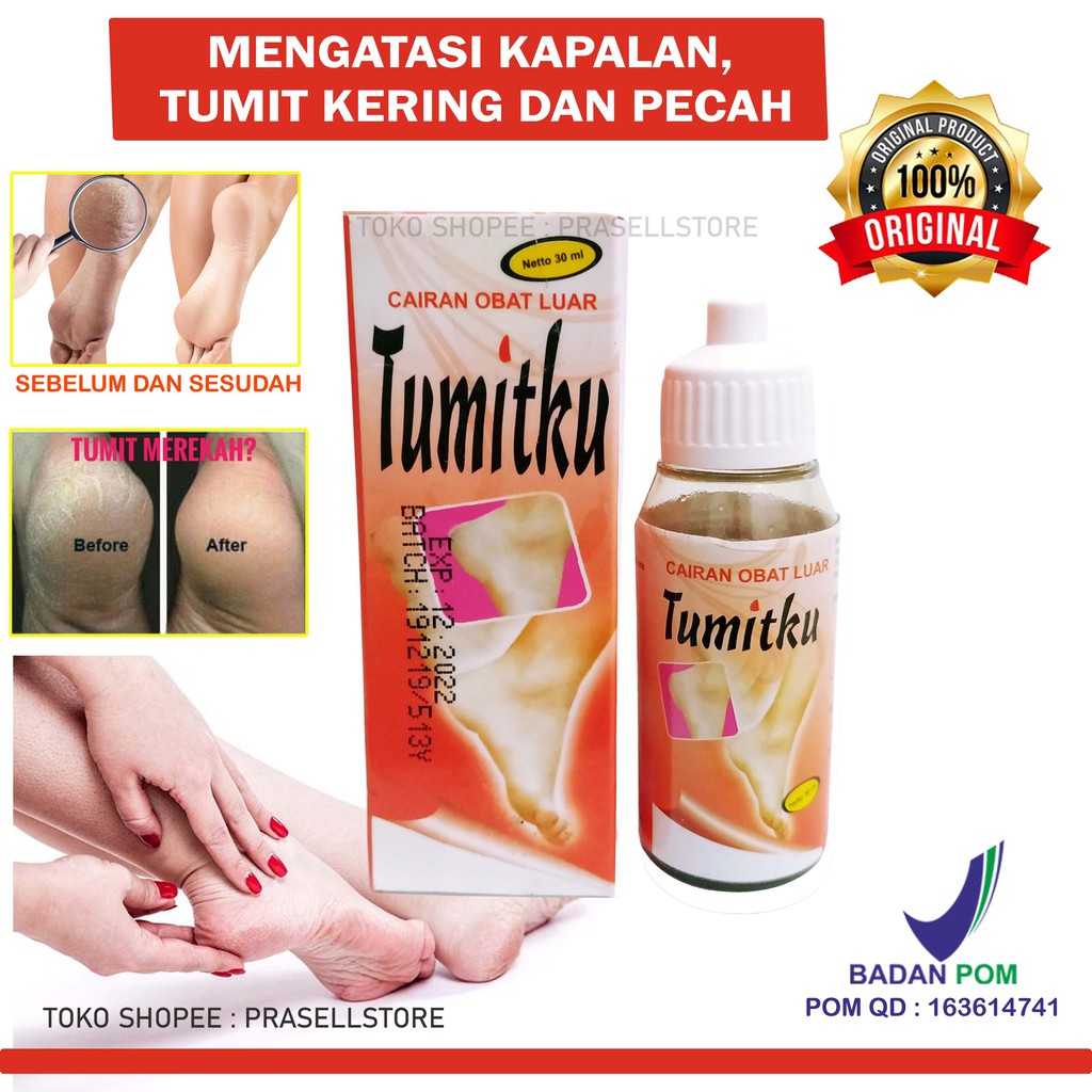 Tumitku - Obat Kapalan dan Kaki Pecah-Pecah 30ml 100% Original