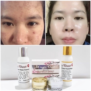 MAGIC DUST PLATINUM KOREA PEMUTIH KULIT WAJAH HILANGKAN FLEK JERAWAT KERIPUT NODA PAKET PERAWATAN WA