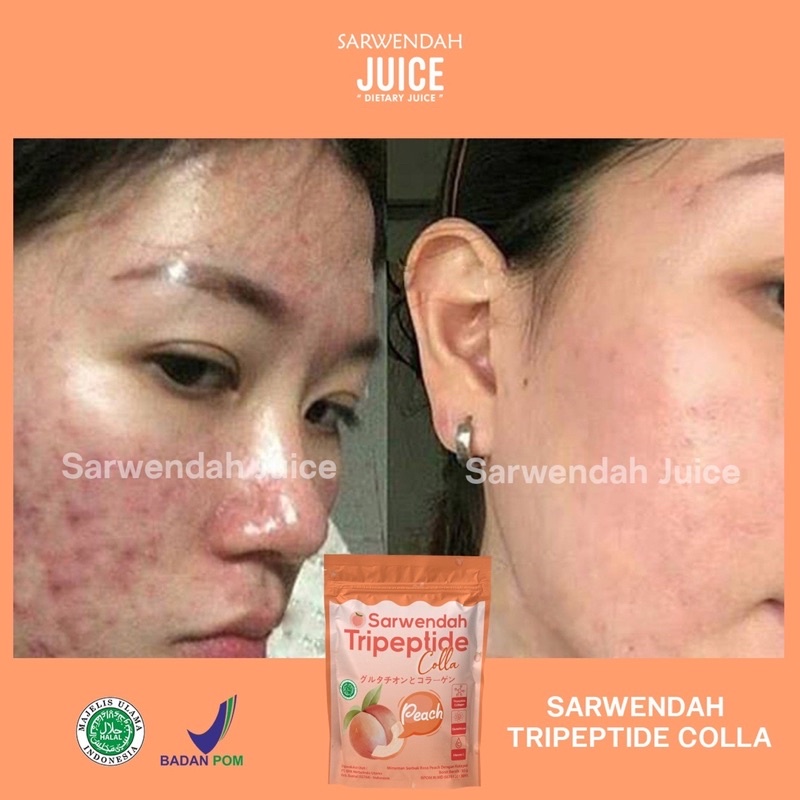 TRIPEPTIDE COLLA PEACH POUCH / COLLAGEN PEACH MENCERAHKAN BADAN WAJAH / MEMUDARKAN BEKAS LUKA SECARA ALAMI / ANTI AGING / WHITENING BOOSTER COLLAGEN