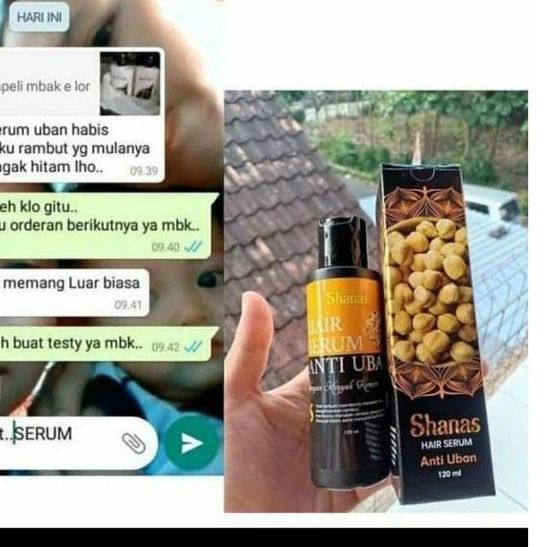 ♥ Paket uban - paket anti uban - Shampo uban - Serum uban - Shampo anti uban - Serum anti uban ™