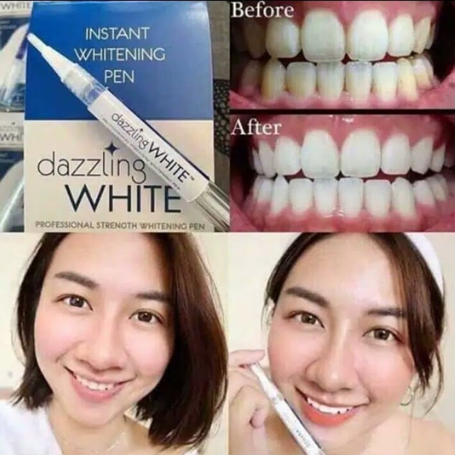 Instant Teeth Whitening Gel Pen Pemutih Gigi Dazzling White Murah Ori Termurah