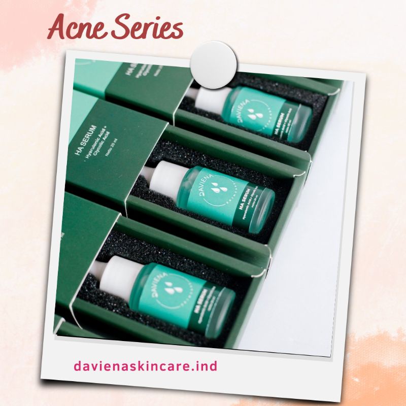 Daviena HA Serum Serum Bopeng Daviena