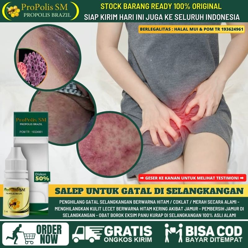 Obat Pemutih Selangkangan Alami, Salep Penghilang Selangkangan Hitam / Merah / Coklat Akibat Infeksi