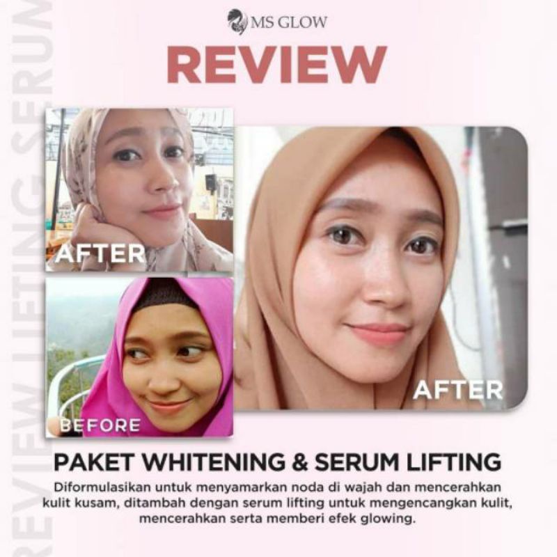 Ms Glow Paket Whitening Skincare Ms Glow Whitening Series Original 100%