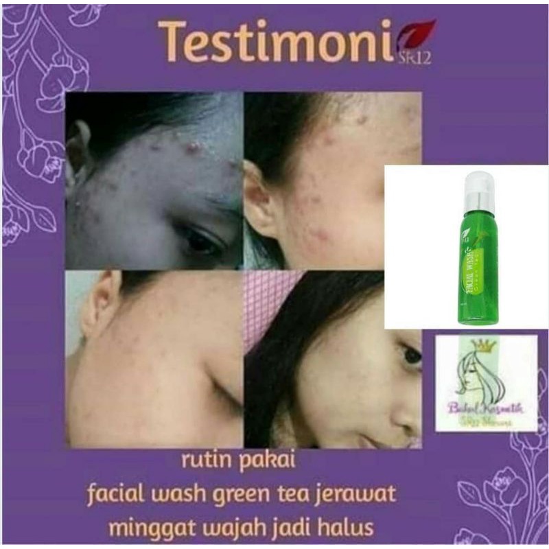 FACIAL WASH GREEN TEA SR12 / SABUN WAJAH GREEN TEA SR12 BPOM / MENCERAHKAN WAJAH / FACIAL WASH GREENTEA / SABUN SEMUA JENIS KULIT