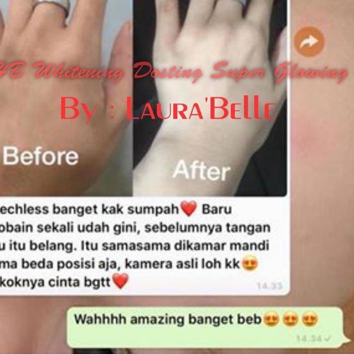 (❁Z787] HB DOSTING WHITENING SUPERGLOW / LOTION PEMUTIH KOREA / PEMUTIH TUBUH PERMANEN