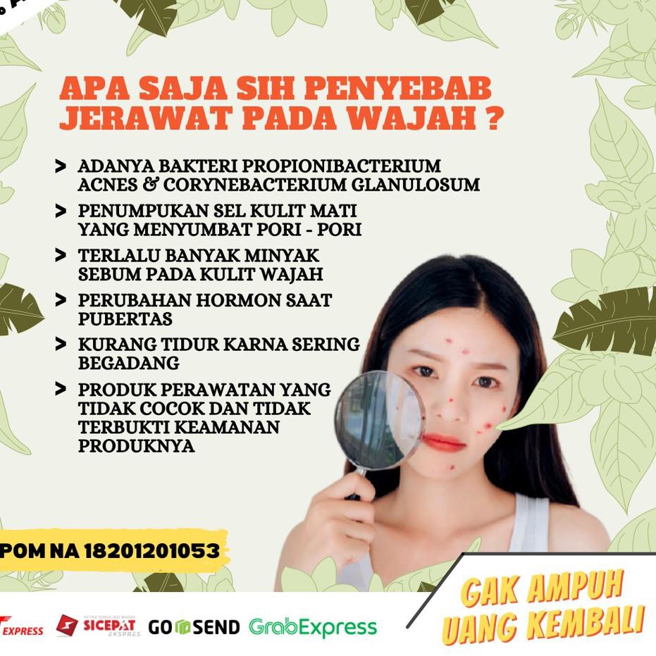 ❊ Sabun Cuci Muka Wanita Pria Remaja Pemutih Pembersih Wajah Penghilang Jerawat Dan Komedo Ampuh ➥