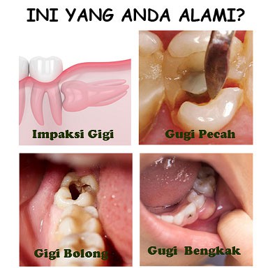 gigi lubang dan gusi bengkak