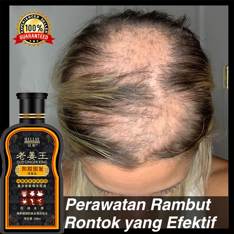 penumbuh rambut  penumbuh rambut botak sampo ketombe  200ml shampo penumbuh rambut cepat Penghapusan rasa gatal Menghilangkan rambut berminyak