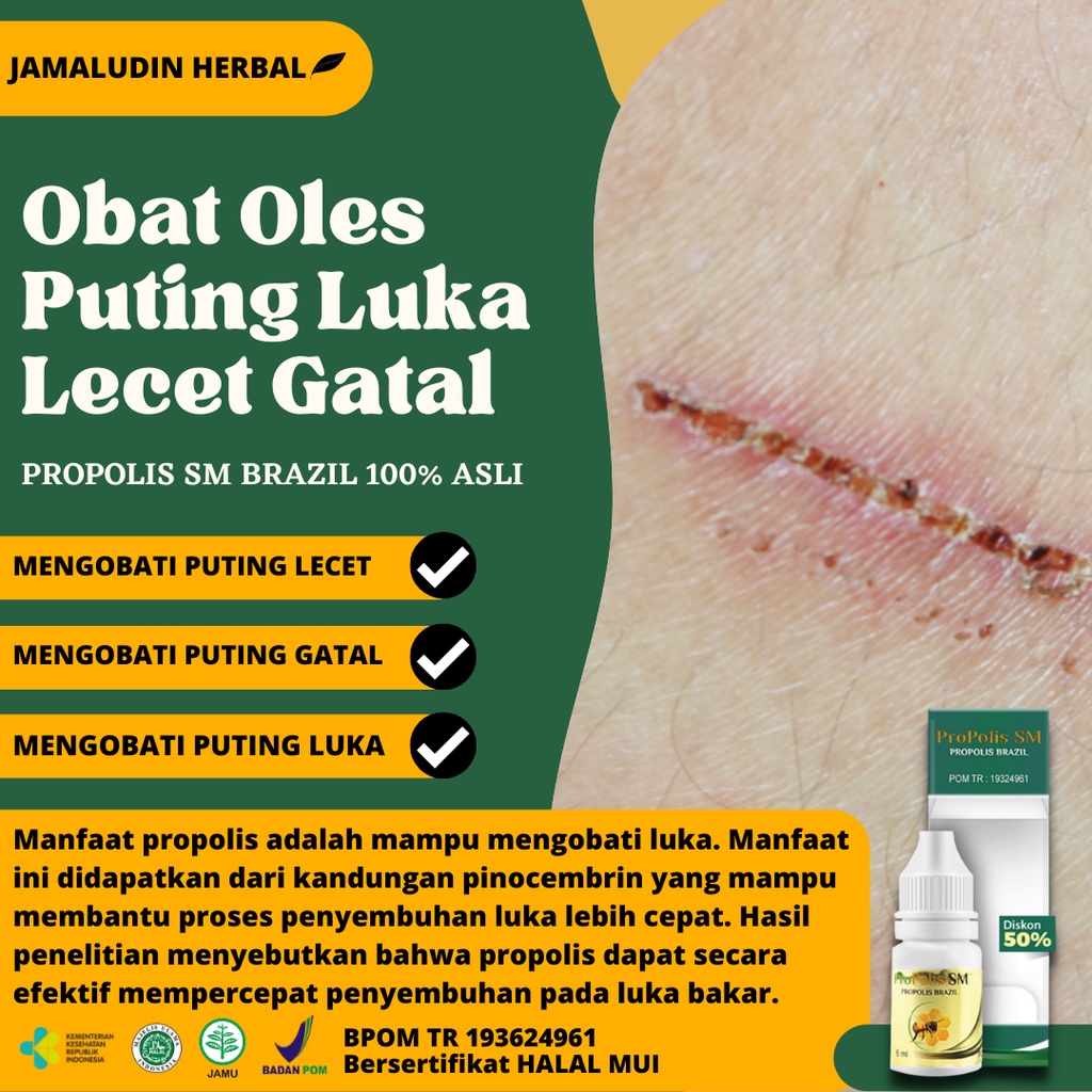 PROPOLIS SM 100% ASLI - Obat Puting Lecet dan Gatal - Obat Lecet Luka Puting Payudara - Obat Puting 