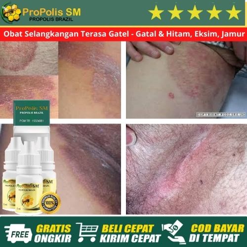 Obat Penghilang Selangkangan Terasa Gatel - Gatal & Hitam, Eksim, Jamur | Obat Iritasi Selangkangan