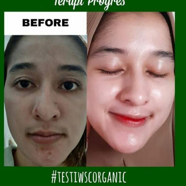 ↼ WSC ORGANIC SKINCARE ORIGINAL BPOM /PAKET WSC ORGANIC/ CREAM WSC ORGANIK / CREAM GLOWING / CREAM J