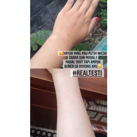 BODY LOTION PENCERAH KULIT /AMAN DOKTER S.p.kk apoteker