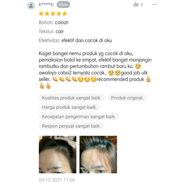 Bio Finmix Minoxidil Penumbuh Rambut Dan Mengatasai Rambut Rontok Hingga Rambut Botak-5