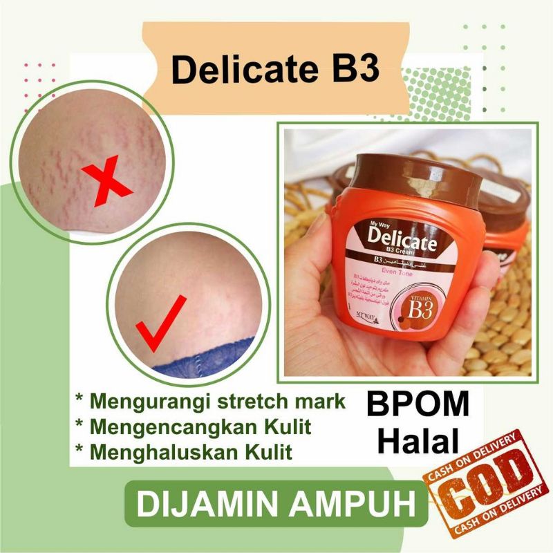 MY WAY Delicate B3 cream penghilang strectmart dan flek hitam BPOM, aman halal bumil busui 100% original