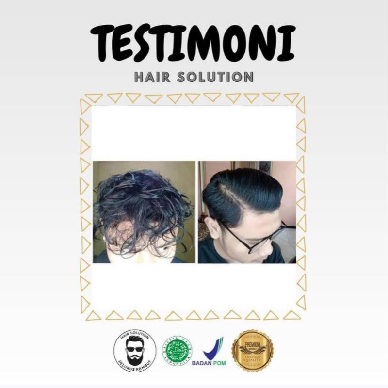 HAIR BYY SOLUTION BEST SELLER 100%ORI-2