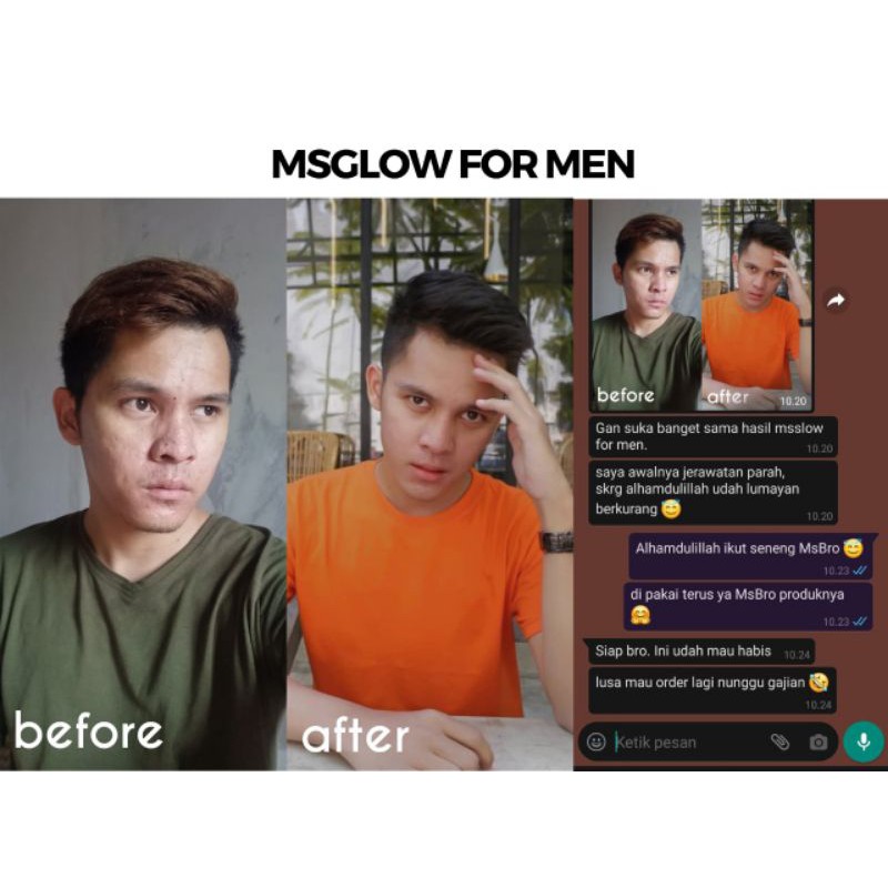 Ms Glow For Men Skincare Pria Paket Complete | Ms Glow For Men Paket Basic | Facial Wash For Men