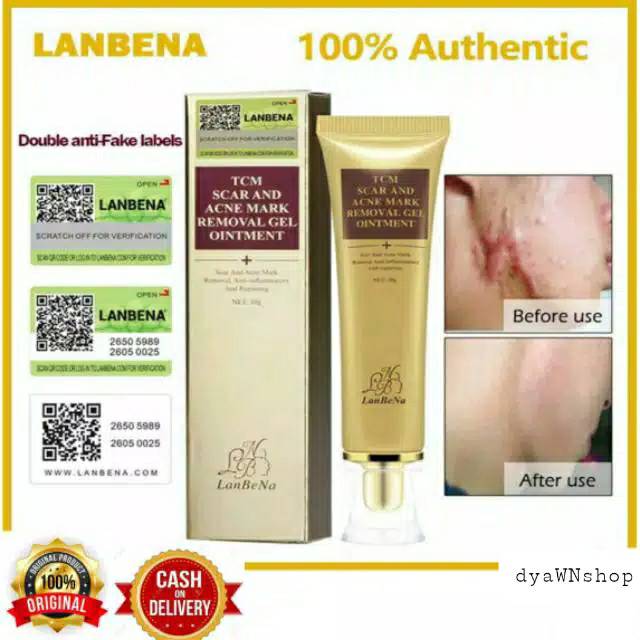 Jual Lanbena Acne Scar Removal Cream Original | Shopee Indonesia