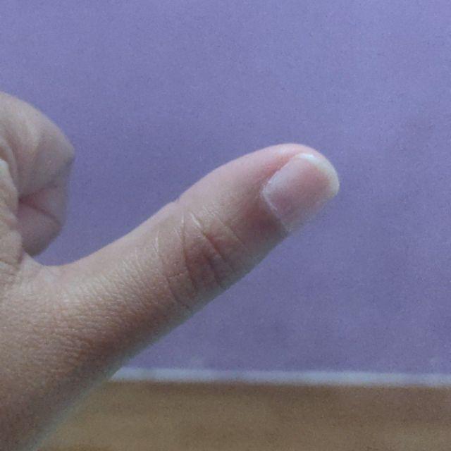 Molto All-in-1 1x Bilas 1600 Ml