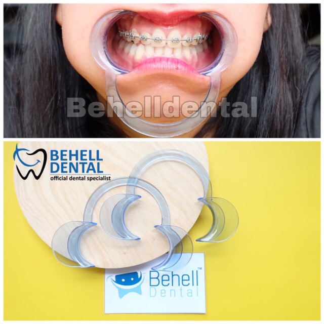 ORI ALAT PEMBUKA MULUT BENTUK C INTRAORAL BIRU CHEEK RETRACTOR PENYANGGA RAHANG GIGI BEHEL MOUTH GAG // Bisa Untuk Anak Dewasa // Elastis Size M L S // Mouth Gate // Mouthgate Original Behelldental