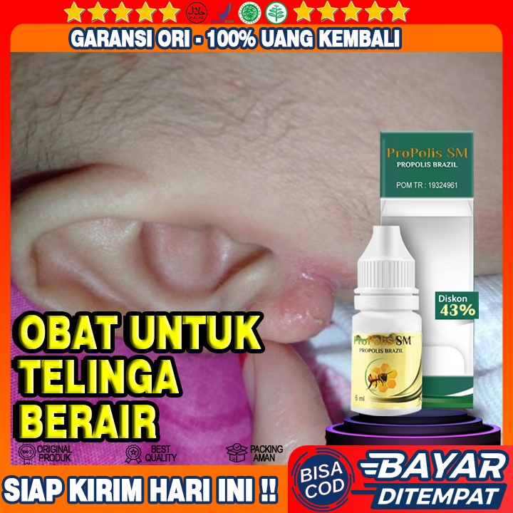 Obat Telinga Berair, Obat Telinga Berair Kuning, Obat Telinga Berair Dan Bau,  Obat Telinga Berair D