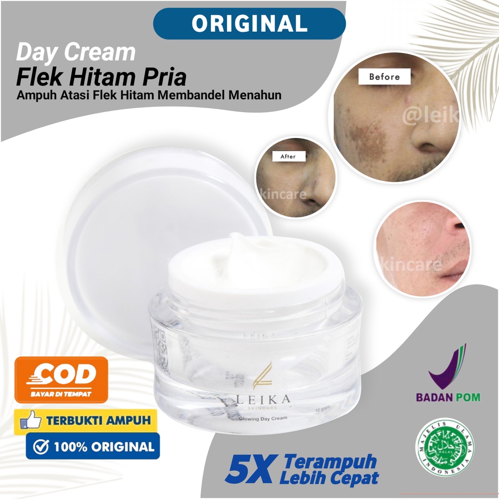 Menghilangkan Flek Hitam Di Wajah Pria Ampuh Permanen Cream Flek Hitam BPOM krem Flek Hitam Penghila