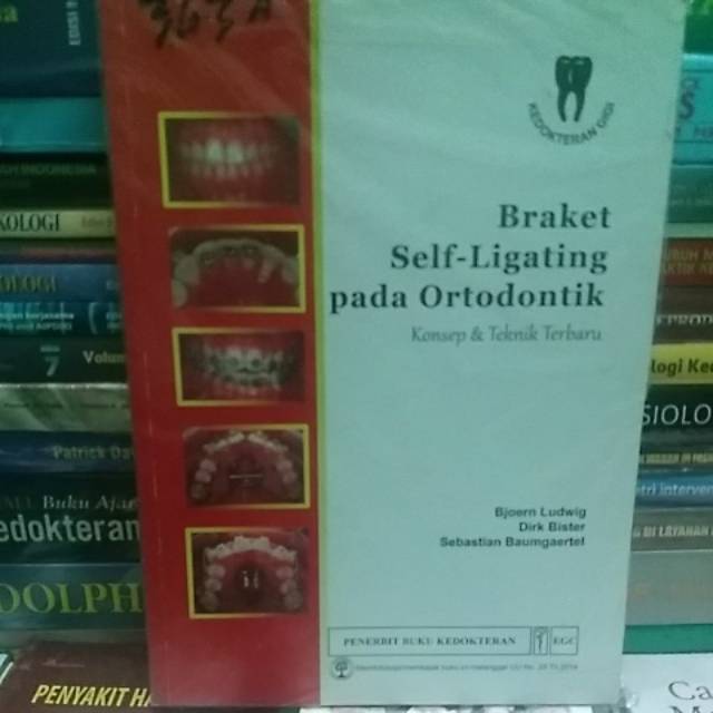 BRAKET SELF--LIGATING PADA ORTODONTIK