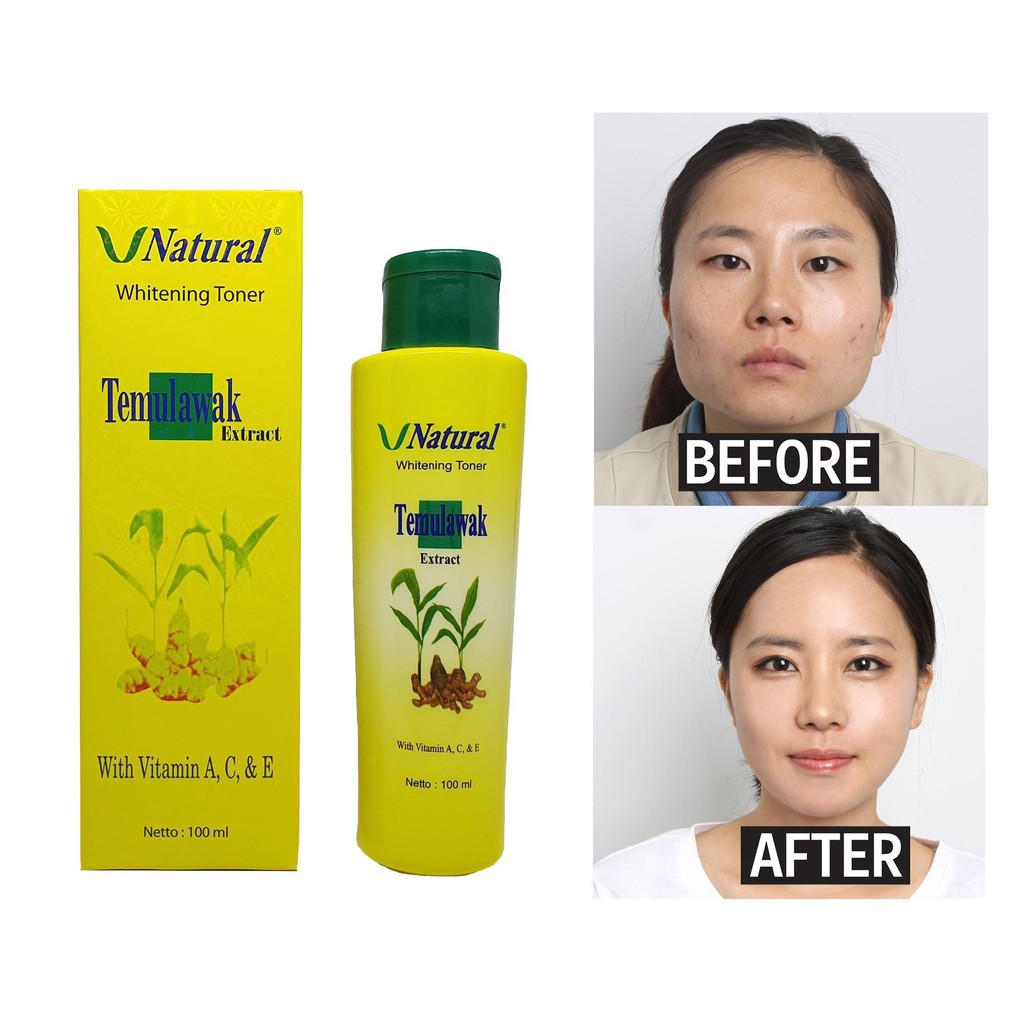 [PERPC] TONER TEMULAWAK  V NATURAL / TONER VINATURAL TONER