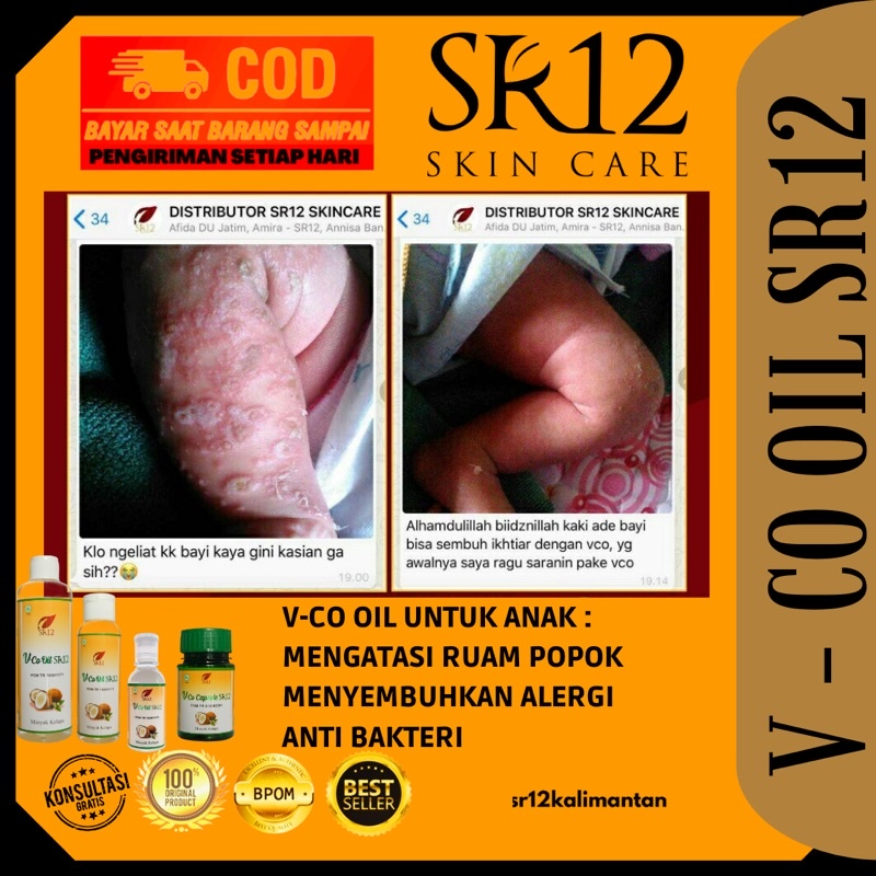 VCO KAPSUL SR12 | MINYAK KELAPA MURNI | MINYAK VCO | BABY OIL