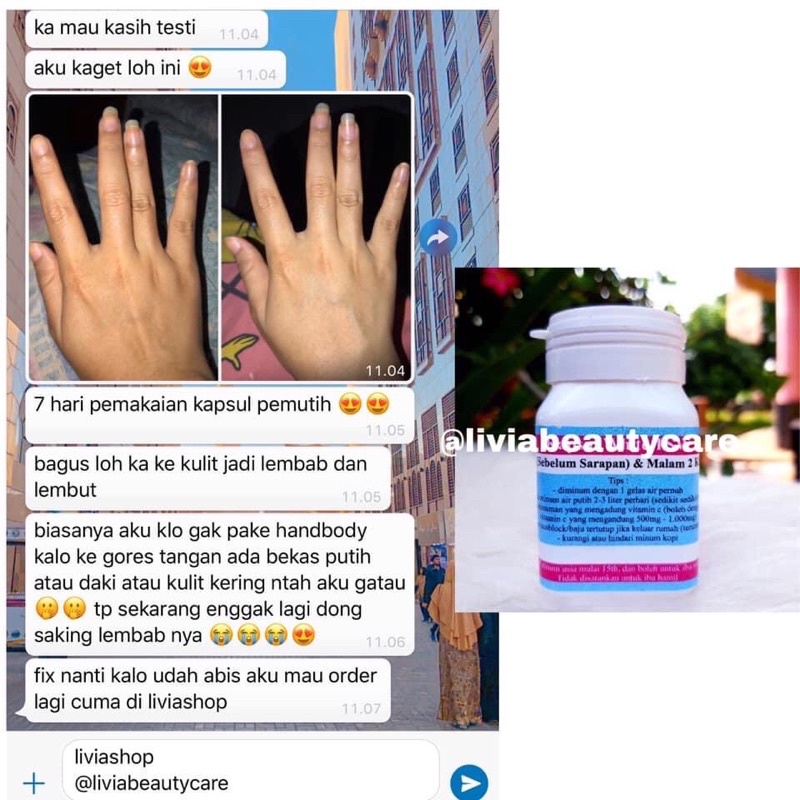 KAPSUL WHITENING PLATINUM AMPUH ISI 40, COLLAGEN isi 30