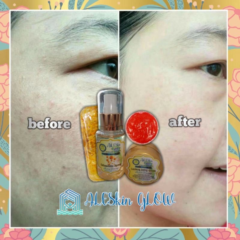 LUXURY ARBUTIN RED JELLY ALESKIN GLOW Paket Perawatan Wajah Korea-Cream Glowing-Skincare Glowing