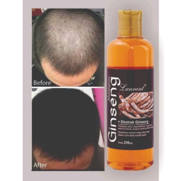 [BISA COD] Shampo Ginseng Penumbuh Rambut Obat Botak Shampo Anti Rontok Vitamin Rambut Hair Care Anti Ketombe