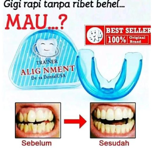 Alat Perapi Gigi...Behel Gigi...Solusi Gigi Rapi