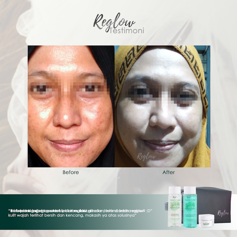 REGLOW SKINCARE [BONUS EXTRA] PAKET GLOWING ORIGINAL BPOM MENCERAHKAN WAJAH PUTIH KENYAL